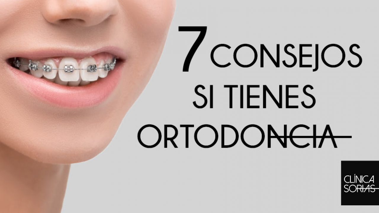 Arcos de Ortodoncia: Todo lo que necesitas Saber