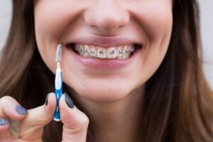 higiene dental ortodoncia - clinica dental sorias