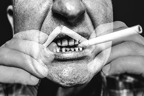 dientes-sucios-blog-clinica-soria