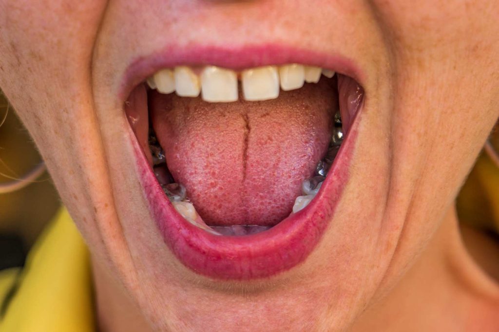 Primer plano de mujer enseñando la lengua