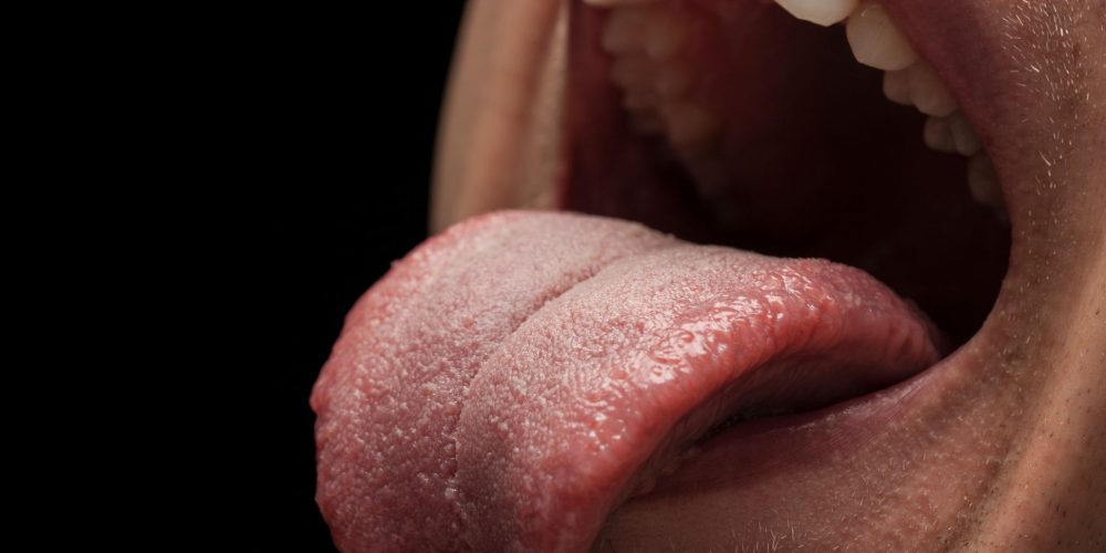 Síndrome de la boca seca o xerostomía