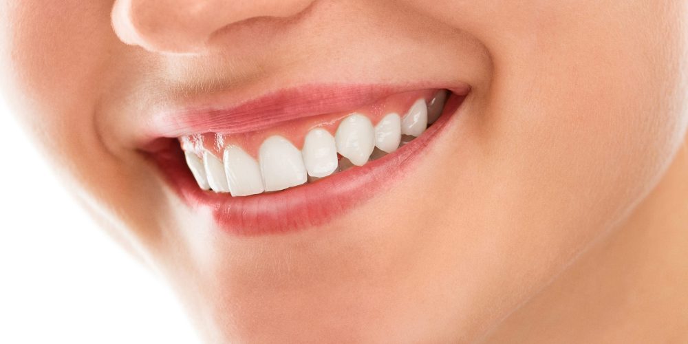 Blanqueamiento dental profesional: ¿Qué es? ¿Cuánto dura?