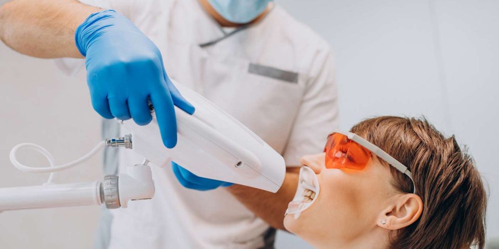 Blanqueamiento dental: precios, tratamiento y tipos | 2025