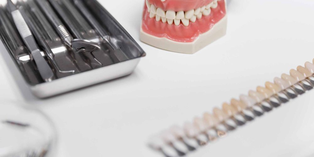 ¿Carillas dentales o coronas? Descubre la mejor opción para ti