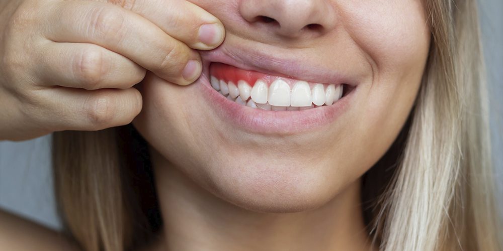 Qué podemos hacer para mantener nuestras encías sanas