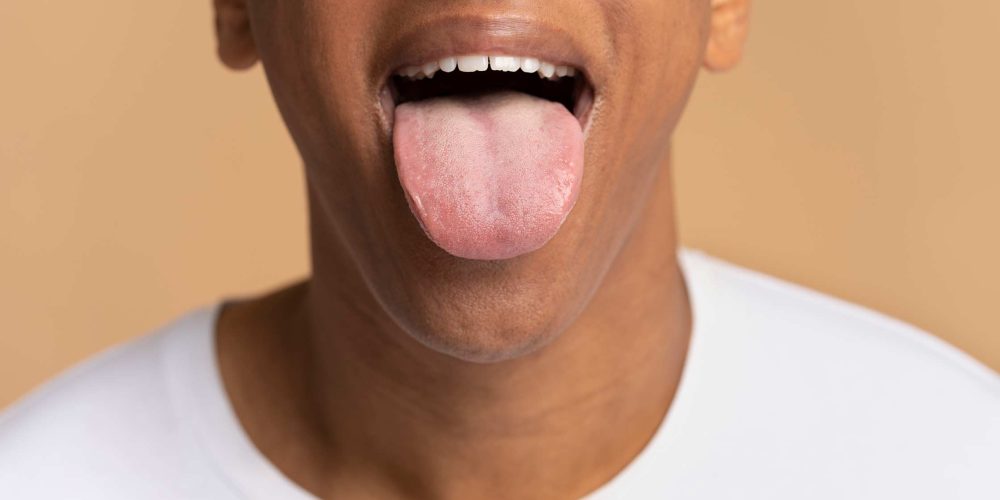 10 Enfermedades de la lengua: Principales problemas y cómo tratarlos