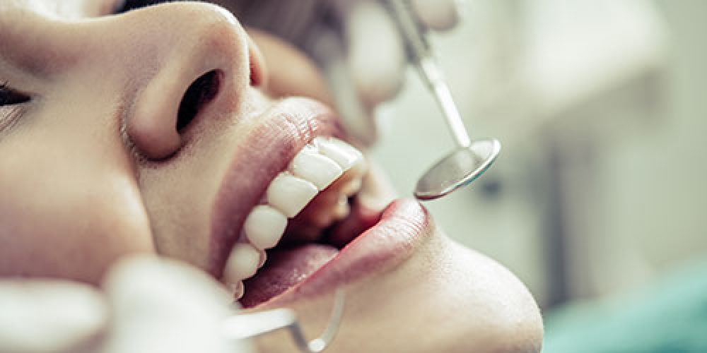 Hablemos de las caries