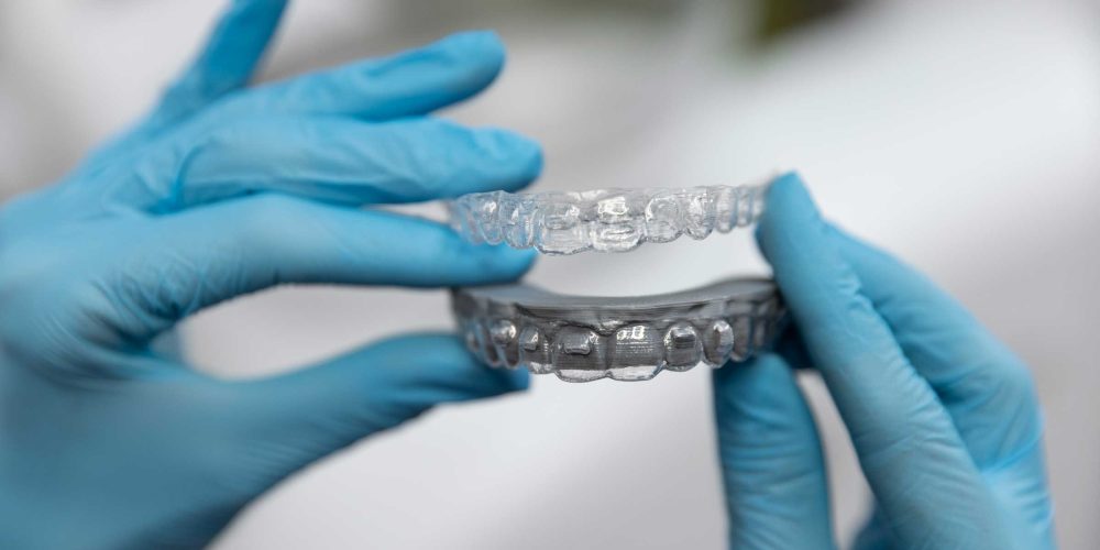 ¿Qué son los retenedores dentales?