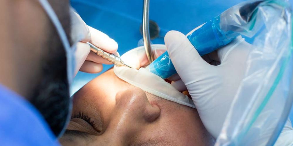 Injerto de encía por retracción gingival: Cuándo es necesario y claves del postoperatorio